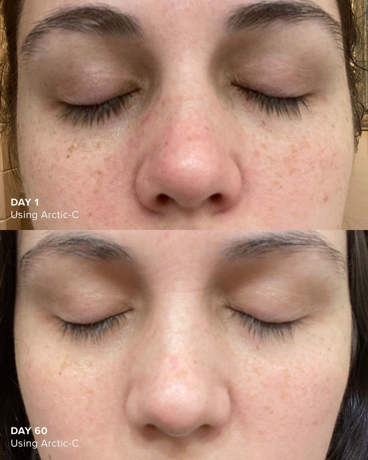 Vitamin C Serum Arctic-C Before and After